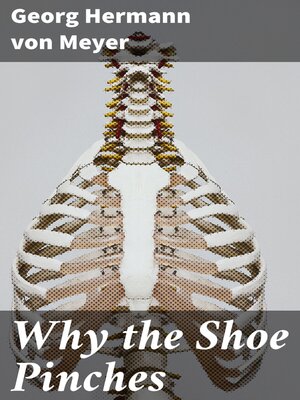 cover image of Why the Shoe Pinches